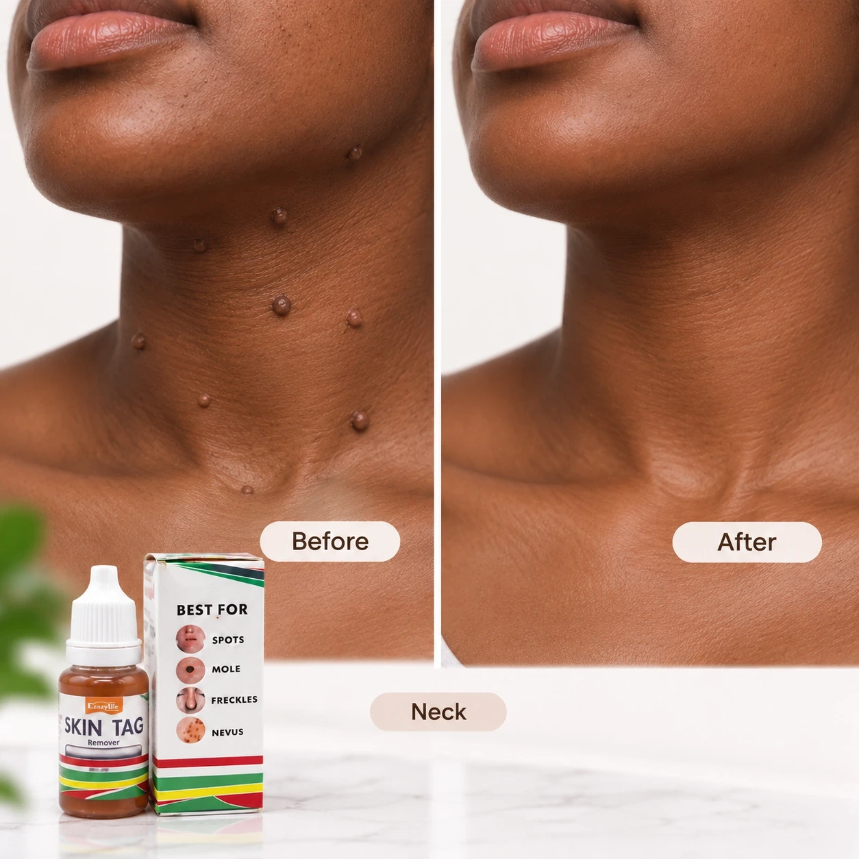 Neck before and after