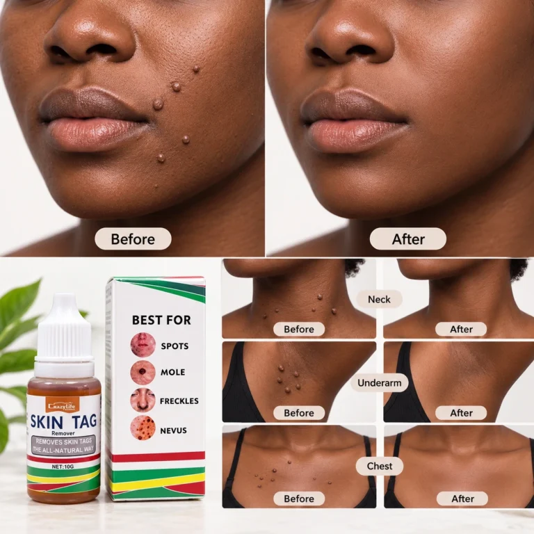 Results on neck, face and underarms