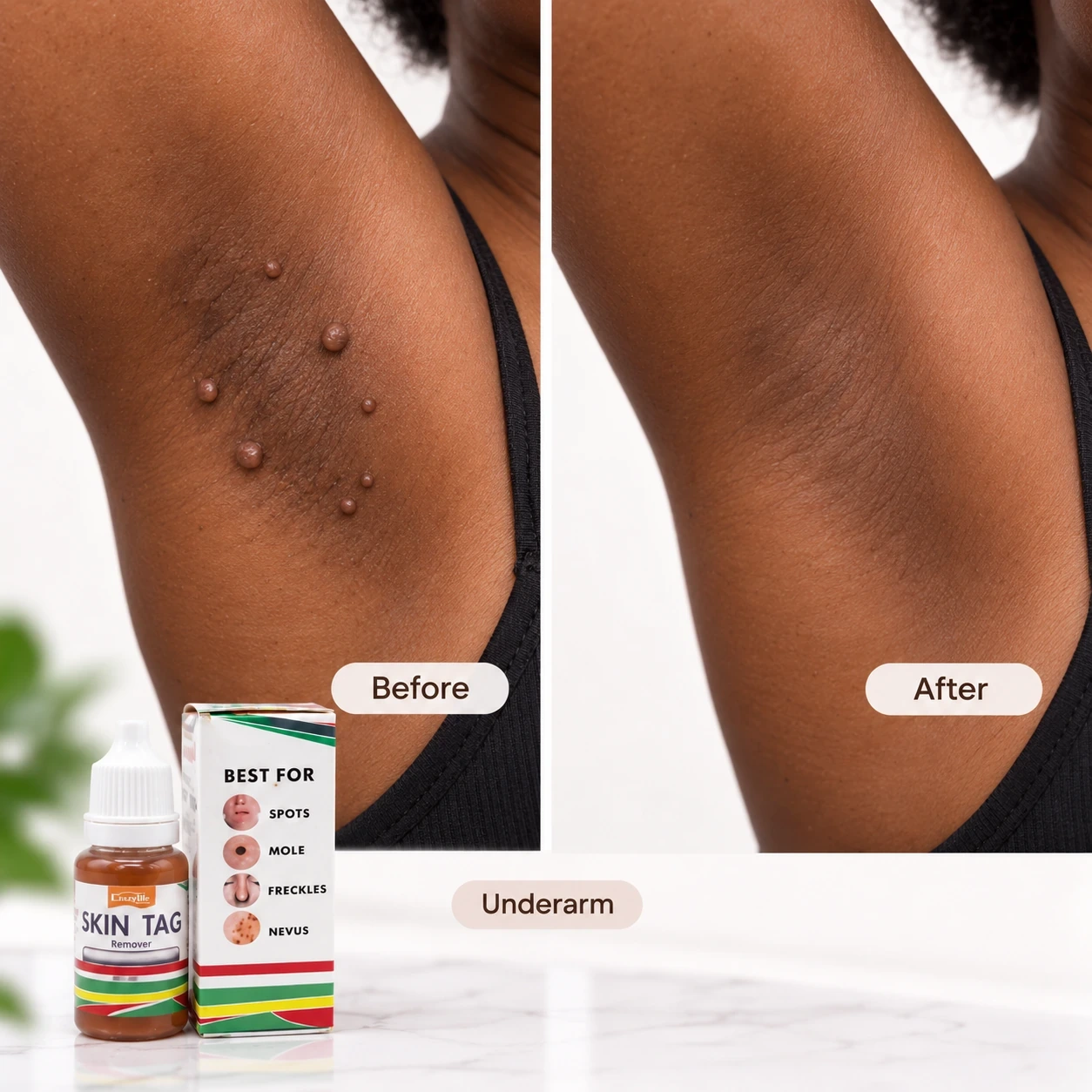 Underarm before and after